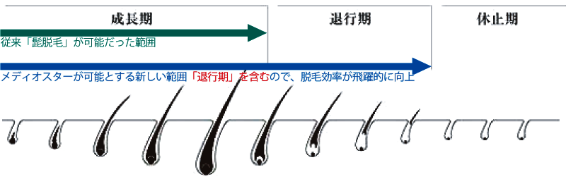 メディオスターNextPro「毛周期」と髭脱毛効果